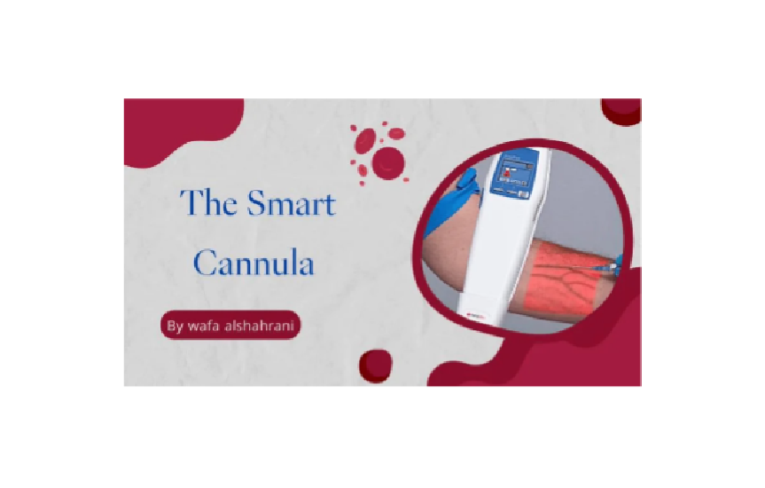 Intravenous cannula device